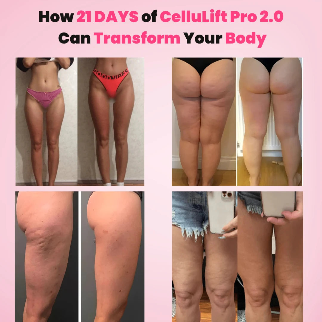 Cellulift Pro 2.0